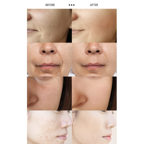 LAENiTA SARRR Melting Powder 5g ×5 unid.