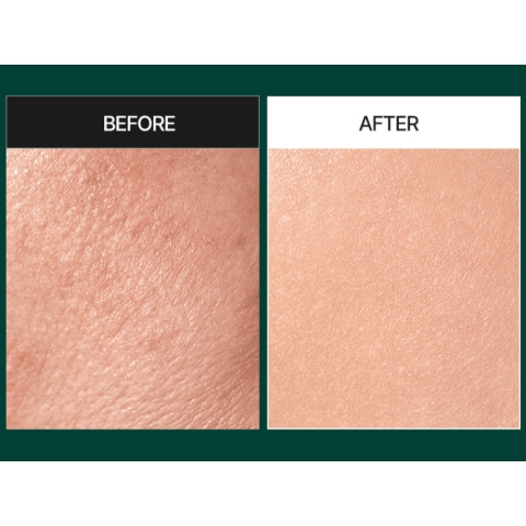Sérum exfoliante suave con espículas y centella MEDIPEEL Phyto Cica-Nol B5 3000 Shot Serum 50 ml