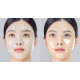 Mascarilla lifting Medi-Peel Extra Super 9 Plus Glow Lifting Wrapping Mask 4×4ml