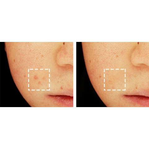 Medi-Peel Cica-Nol — Gel limpiador calmante y refrescante 30 ml